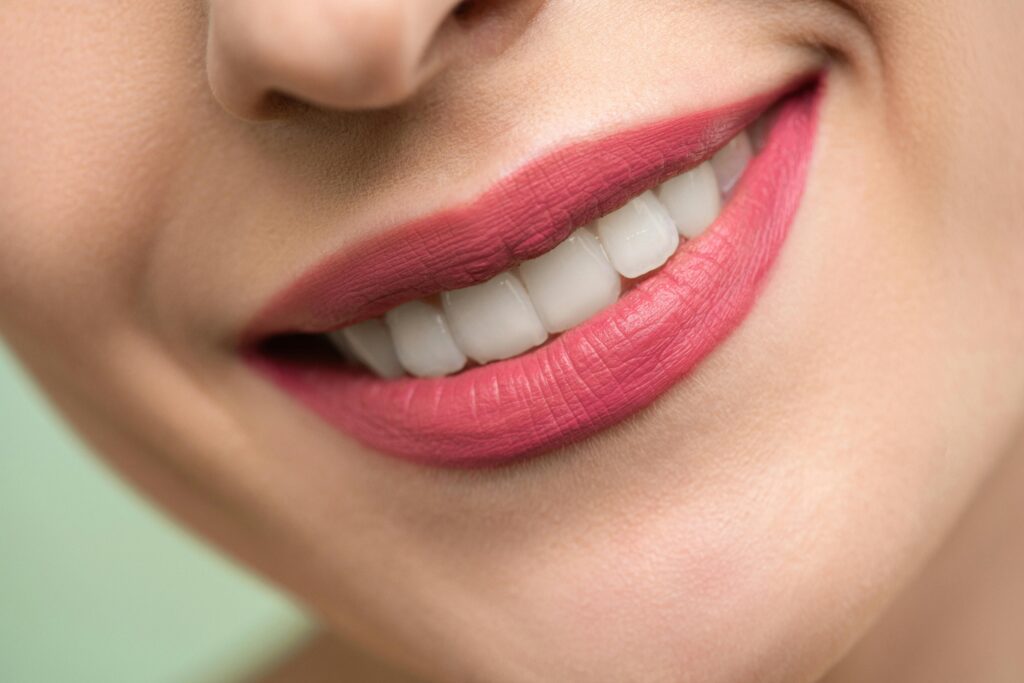 pexels-photo-3762453-3762453 Vivid close-up image of a woman's smile showcasing red lipstick and white teeth on a light background.